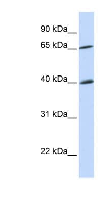 Polyclonal Rabbit anti-Human CHEK2 / CHK2 Antibody (N-Terminus, WB)