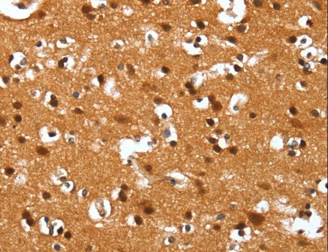 HNP-4 / DEFA4 Antibody