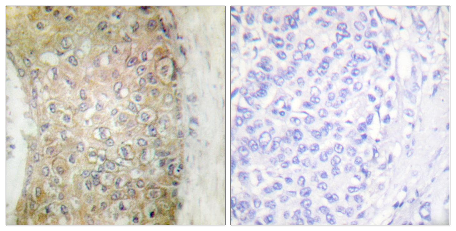 HSPB6 / HSP20 Antibody
