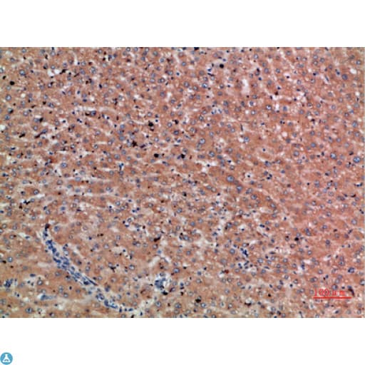Polyclonal Rabbit anti-Human Chordin Antibody (IHC)