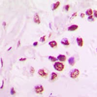 ETV6 / TEL Antibody (aa 396-435)