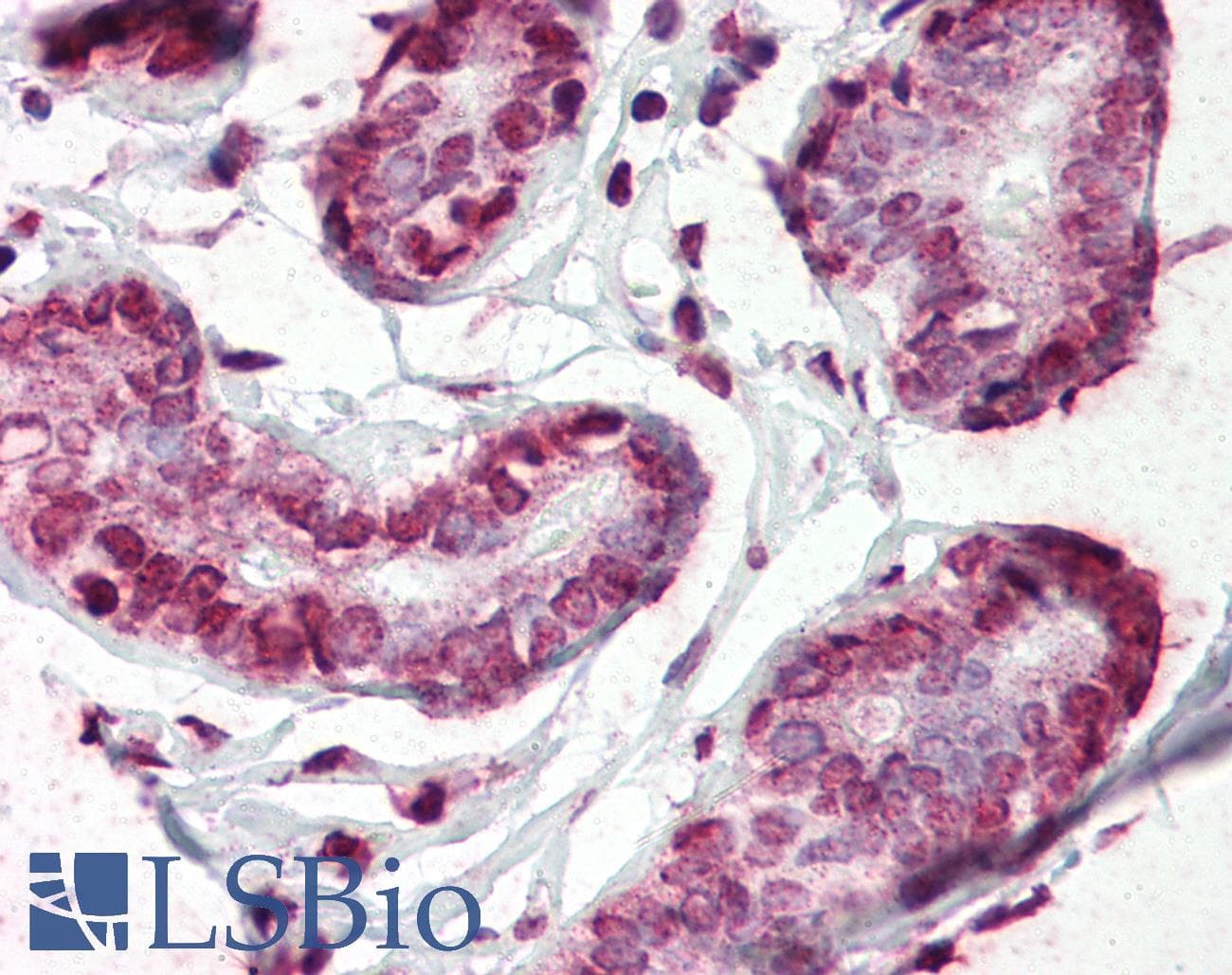 IHC-plus™ CD44 Antibody (aa21-145, clone 5C10)