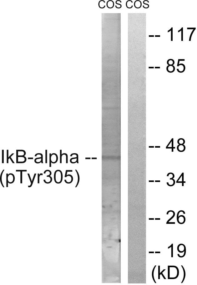 NFKBIA / IKB Alpha / IKBA Antibody (phospho-Tyr305)