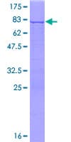 Human RPL3 / Ribosomal Protein L3 (Recombinant GST)