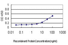 NFKBIB / IKB Beta / IKBB Antibody (clone 1B5)