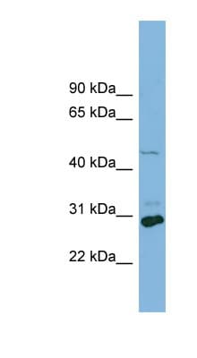 SLC16A1 / MCT1 Antibody (aa215-264)