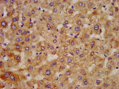 HAO1 Antibody
