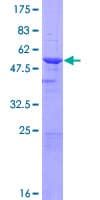 Human MCNAA / BPHL Protein (Recombinant GST)