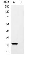 Myc Tag Antibody