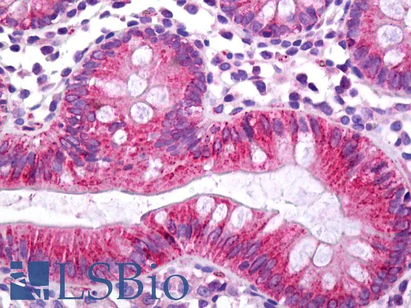 IHC-plus™ Polyclonal Rabbit anti-Human CES2 / Esterase Antibody (C-Terminus, IHC, WB)