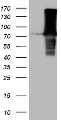 URP2 / FERMT3 Antibody (aa259-528, clone OTI2G2)
