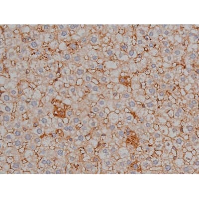 MAPT / Tau Antibody (phospho-Ser404)