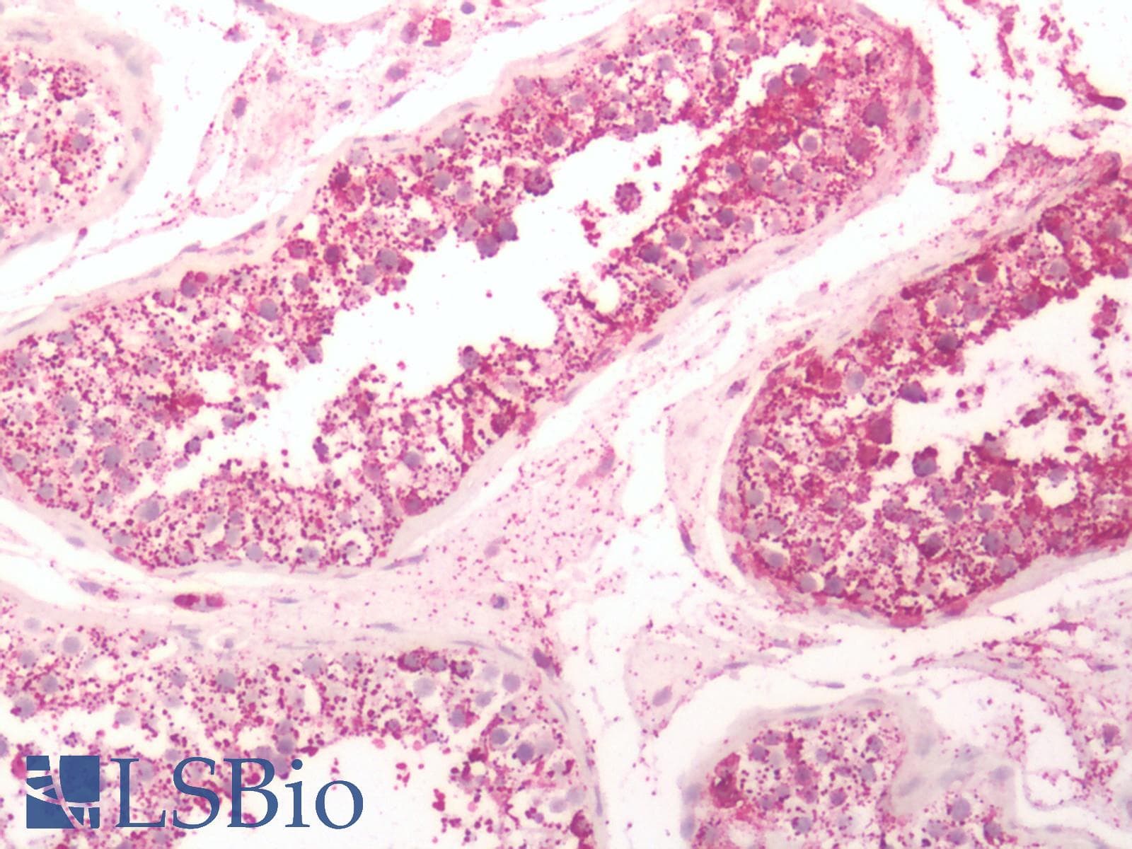 PathPlus™ Polyclonal Rabbit anti-Human GPR6 Antibody (C-Terminus, IHC)