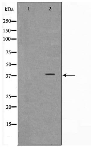 NT5C3A Antibody