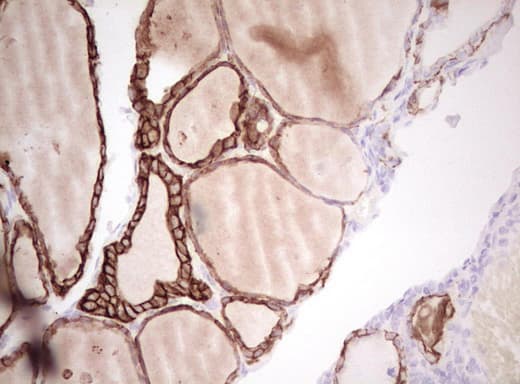 Monoclonal Mouse anti-Human Basic Cytokeratin AE3 Antibody (clone AE3, Carrier-free, IHC)