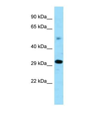 Polyclonal Rabbit anti-Mouse ZNF202 Antibody (N-Terminus, WB)