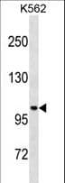 Polyclonal Rabbit anti-Human STARD13 Antibody (aa544-573, WB)