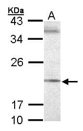 Polyclonal Rabbit anti-Human SEC61G Antibody (aa2-66, WB)