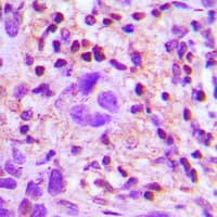 TGFB2 / TGF Beta2 Antibody (C-Terminus)