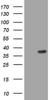 Monoclonal Mouse anti-Human PIK3C2A Antibody (clone OTI2C10, aa230-560, IHC, WB)