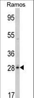 Polyclonal Rabbit anti-Human PGLS / 6PGL Antibody (aa191-220, IHC, WB)