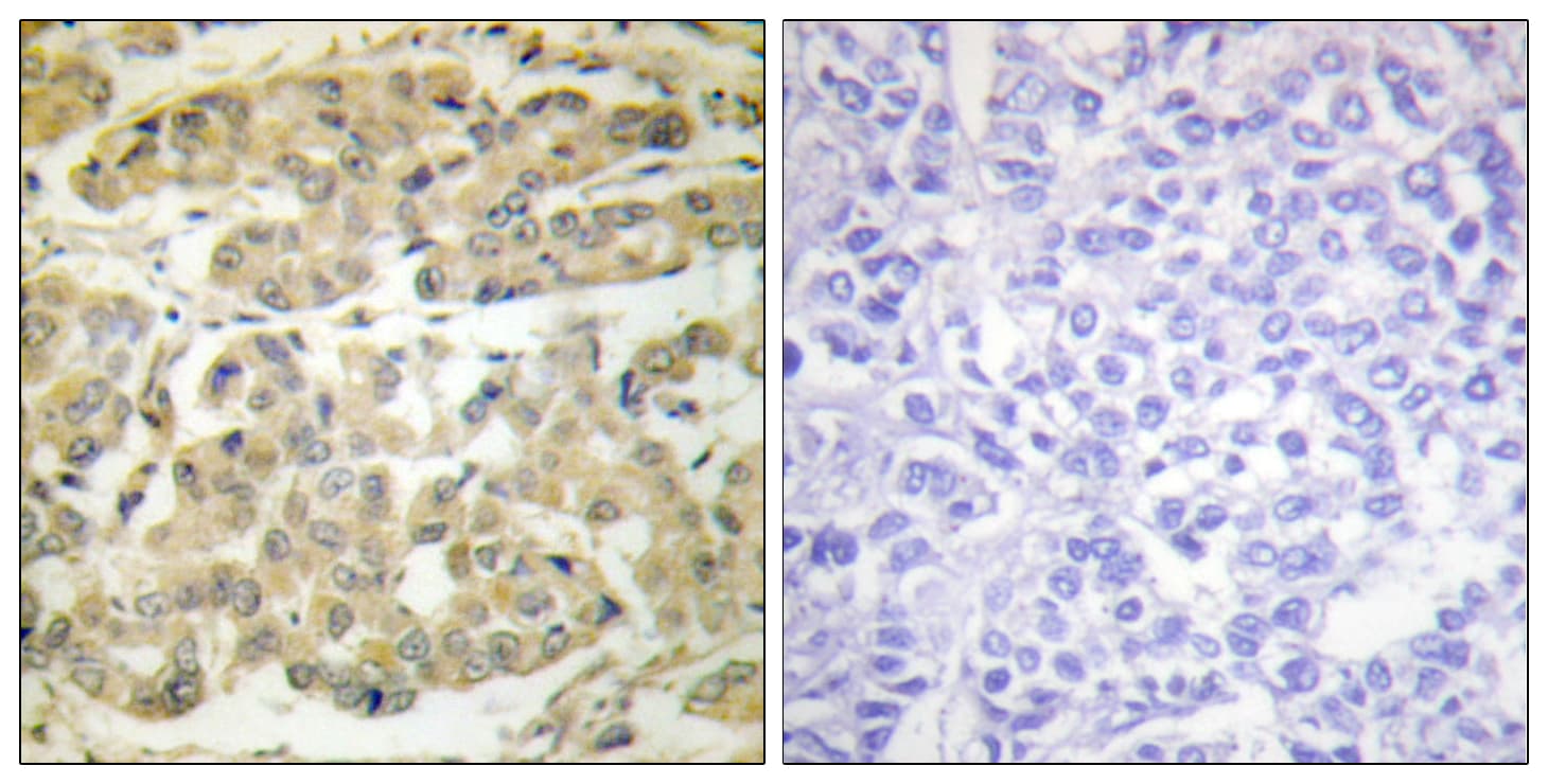 YWHAZ / 14-3-3 Zeta Antibody (phospho-Ser58)