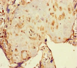 NR1H3 / LXR Alpha Antibody