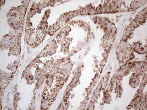 Monoclonal Mouse anti-Human ANGPTL8 / Betatrophin Antibody (clone OTI1B12, Carrier-free, aa22-198, IHC, WB)