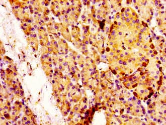 MAP3K4 / MEKK4 Antibody