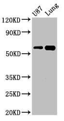 Polyclonal Rabbit anti-Human SHC3 / SHCC Antibody (WB)