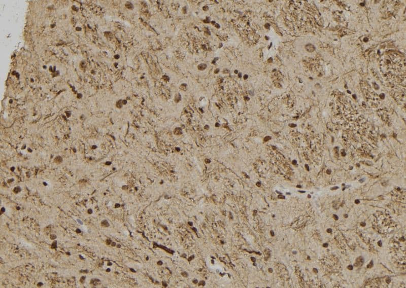 HUS1B Antibody
