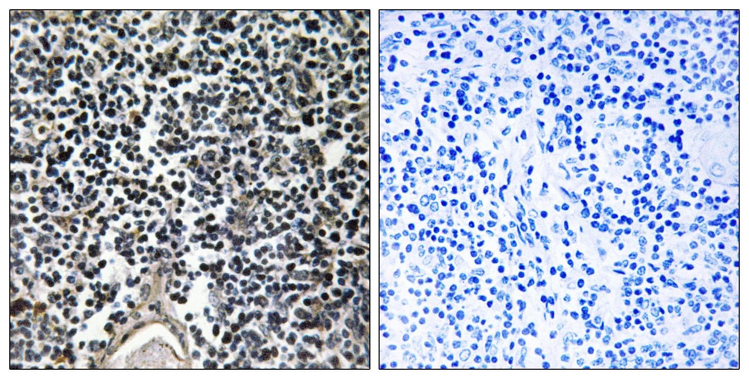 ABCB7 Antibody