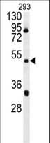 ILKAP Antibody (aa243-270)