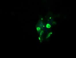 IHC-plus™ GLB1 / Beta-Galactosidase Antibody (clone 2F6)