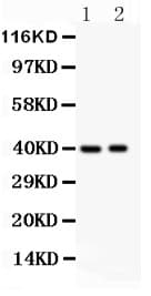 Polyclonal Rabbit anti-Human IRF4 Antibody (aa272-451, IHC, WB)