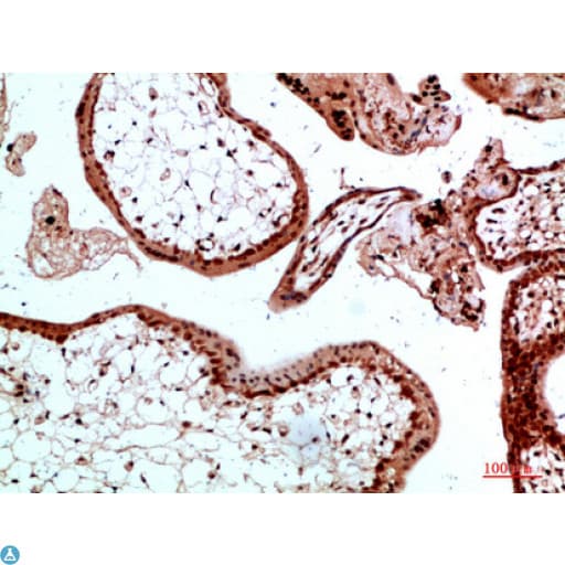 Polyclonal Rabbit anti-Human Ubiquitin Antibody (IHC)