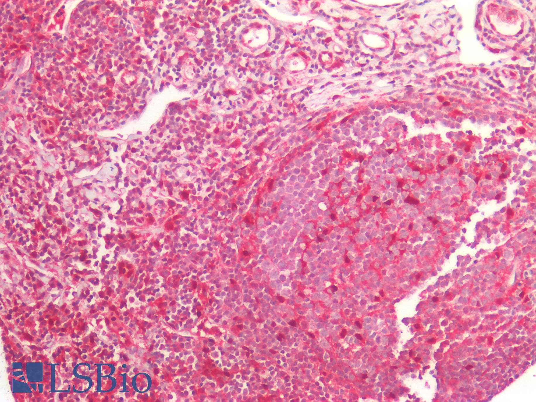 PathPlus™ TP / Thymidine Phosphorylase Antibody (clone 7A6)