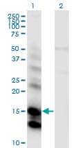 CST6 / Cystatin E/M Antibody (clone 2H8)