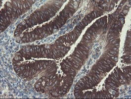 Monoclonal Mouse anti-Human GORAB / SCYL1BP1 Antibody (clone OTI1E3, aa35-394, IHC, WB)