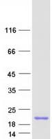 Human LBH Protein (Recombinant Myc-DDK (Flag))