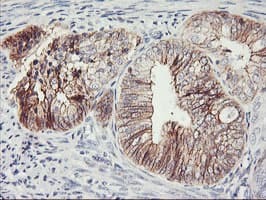 CDH2 / N Cadherin Antibody (clone OTI2G7)