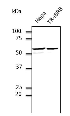 IHC-plus™ Polyclonal Goat anti-Human PDIA3 / ERp57 Antibody (C-Terminus, IHC, IF, WB)