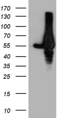 Monoclonal Mouse anti-Human GDI1 Antibody (clone OTI8B2, WB)