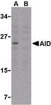 IHC-plus™ AICDA / AID Antibody