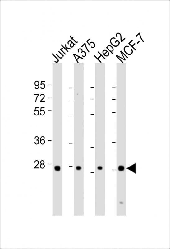 PSMB7 Antibody (aa180-211)