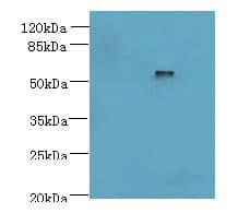 Polyclonal Rabbit anti-Human DENND2D Antibody (WB)