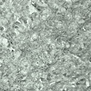 Polyclonal Rabbit anti-Human SYT17 Antibody (Internal, IHC, WB)