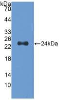SLIT2 Antibody (aa1160-1333, Biotin)