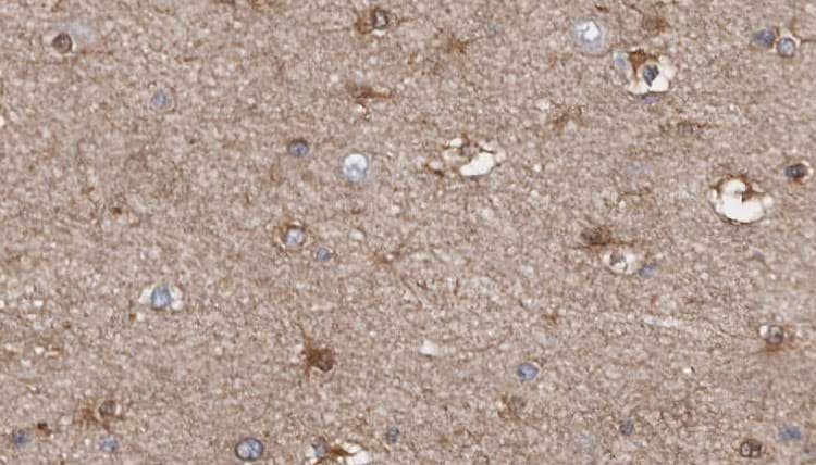 Polyclonal Rabbit anti-Human MRPL28 Antibody (IHC, WB)