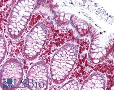 PathPlus™ KCNJ2 / Kir2.1 Antibody (Internal)
